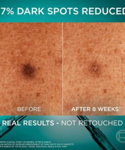 سرم ضدلک و روشنکننده نیاسینامید برایت ریویل لورآل 30 میل L'Oreal Paris Bright Reveal Niacinamide Dark Spot Serum 7 سرم ضدلک و روشنکننده نیاسینامید برایت ریویل لورآل 30 میل L'Oreal Paris Bright Reveal Niacinamide Dark Spot Serum