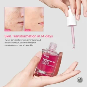 سرم ضد لک آنوا نیاسینامید ۱۰٪ و ترانگزامیک اسید ۴٪ حجم ۳۰ میل Anua Niacinamide 10 TXA 4 Serum 8 نقد و بررسی:سرم ضد لک آنوا نیاسینامید ۱۰٪ و ترانگزامیک اسید ۴٪ حجم ۳۰ میل Anua Niacinamide 10 TXA 4 Serum