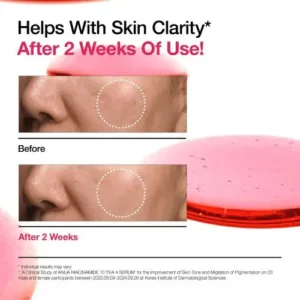 سرم ضد لک آنوا نیاسینامید ۱۰٪ و ترانگزامیک اسید ۴٪ حجم ۳۰ میل Anua Niacinamide 10 TXA 4 Serum 9 نقد و بررسی:سرم ضد لک آنوا نیاسینامید ۱۰٪ و ترانگزامیک اسید ۴٪ حجم ۳۰ میل Anua Niacinamide 10 TXA 4 Serum