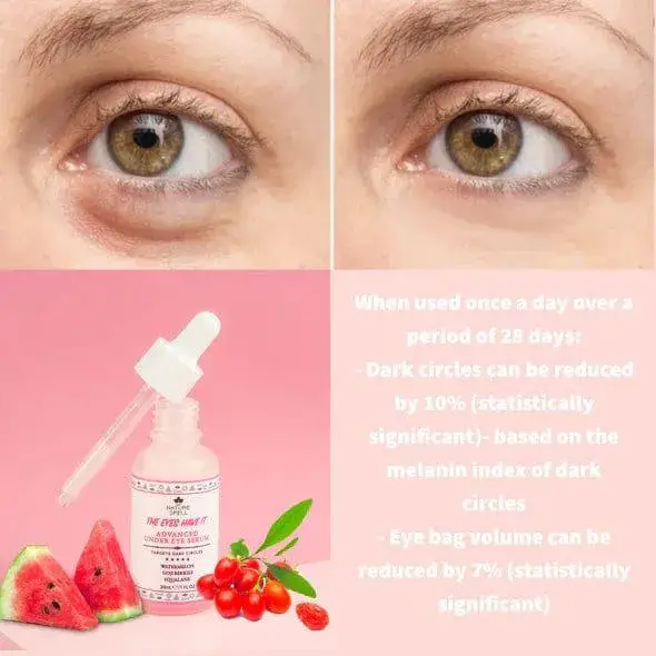 سرم دور چشم نیچر اسپل آبرسان گیاهی ۳۰ میل NATURE SPELL The Eyes Have It 4 نقد و بررسی:سرم دور چشم نیچر اسپل آبرسان با اسکوالان گیاهی، هندوانه و گوجی بری ۳۰ میل NATURE SPELL The Eyes Have It
